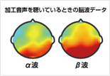 脳波データ図